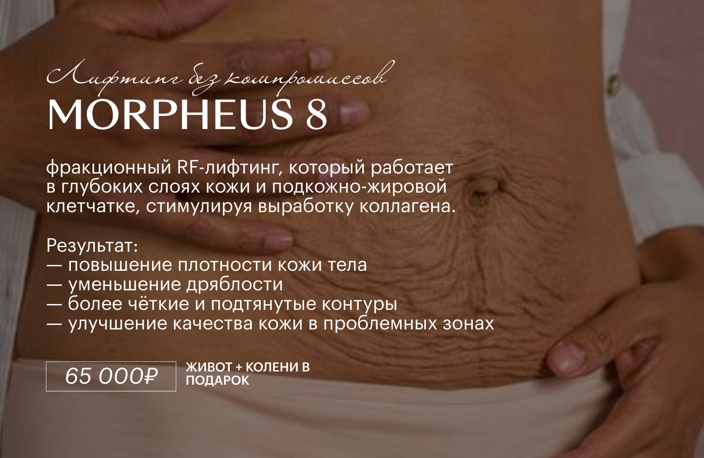 Morpheus 8 — лифтинг без компромиссов
