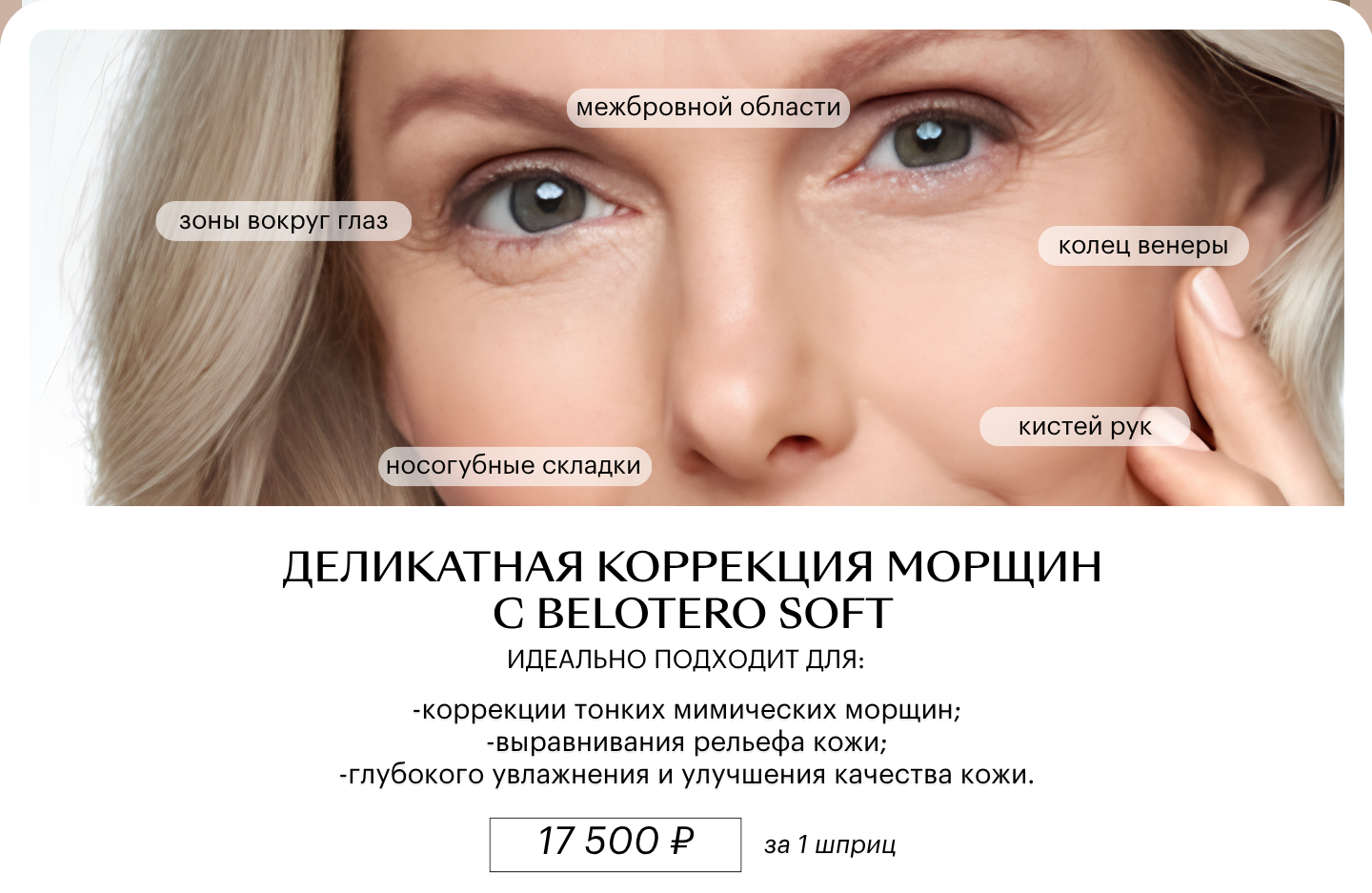 Belotero Soft — деликатная коррекция возрастных изменений